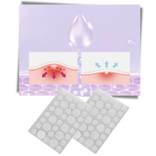 Carica l'immagine nel visualizzatore di Gallery, Confezione da 36 cerotti invisibili per l'acne - Ozerty