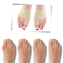 Carica l'immagine nel visualizzatore di Gallery, Correttore di alluce valgo in gel