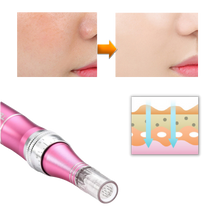 Carica l'immagine nel visualizzatore di Gallery, Penna per micro-needling dermico - Ozerty