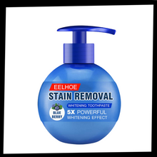 Carica l'immagine nel visualizzatore di Gallery, Sbiancamento rapido dei denti - Ozerty