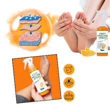 Carica l'immagine nel visualizzatore di Gallery, Spray Esfoliante per i Piedi - Ozerty
