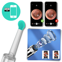 Carica l'immagine nel visualizzatore di Gallery, Telecamera intelligente per la rimozione del cerume dall'orecchio - Ozerty