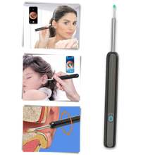 Carica l'immagine nel visualizzatore di Gallery, Telecamera intelligente per la rimozione del cerume dall'orecchio - Ozerty