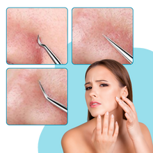 Carica l'immagine nel visualizzatore di Gallery, Pinzette a punta ultra precise - Ozerty