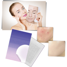 Carica l&#39;immagine nel visualizzatore di Gallery, Confezione da 36 cerotti invisibili per l&#39;acne - Ozerty

