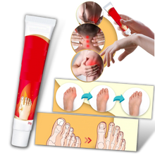 Carica l&#39;immagine nel visualizzatore di Gallery, Crema antinfiammatoria per l&#39;alluce valgo - Ozerty
