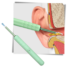 Carica l&#39;immagine nel visualizzatore di Gallery, Bastone intelligente per la pulizia dell&#39;orecchio - Ozerty
