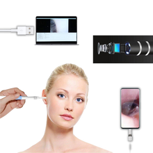 Carica l&#39;immagine nel visualizzatore di Gallery, 3 in 1 Telecamera auricolare - Ozerty
