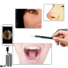 Carica l&#39;immagine nel visualizzatore di Gallery, 3 in 1 Telecamera auricolare - Ozerty
