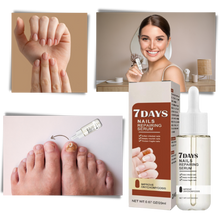 Carica l&#39;immagine nel visualizzatore di Gallery, Essenza per la riparazione delle unghie 7 giorni - Ozerty
