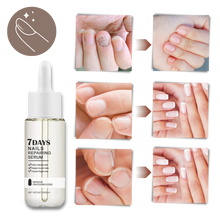 Carica l&#39;immagine nel visualizzatore di Gallery, Essenza per la riparazione delle unghie 7 giorni - Ozerty
