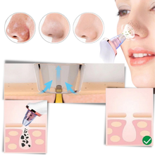 Carica l&#39;immagine nel visualizzatore di Gallery, Aspiratore per punti neri - Ozerty
