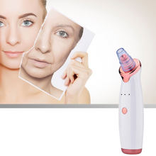 Carica l&#39;immagine nel visualizzatore di Gallery, Aspiratore per punti neri
