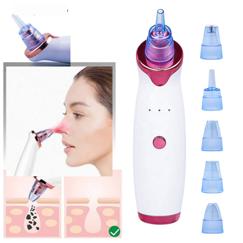 Aspiratore per punti neri - Ozerty