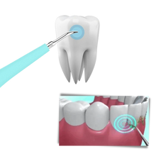 Carica l&#39;immagine nel visualizzatore di Gallery, Macchina per la pulizia profonda del tartaro dei denti - Ozerty
