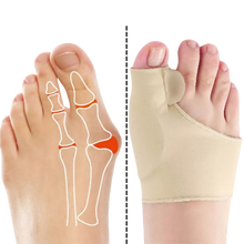 Carica l&#39;immagine nel visualizzatore di Gallery, Correttore di alluce valgo in gel - Ozerty
