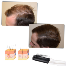 Carica l&#39;immagine nel visualizzatore di Gallery, Pettine laser a infrarossi - Ozerty
