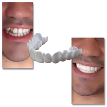 Carica l&#39;immagine nel visualizzatore di Gallery, Copertura dentale del sorriso perfetto - faccette confortevoli - Ozerty
