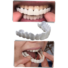Carica l&#39;immagine nel visualizzatore di Gallery, Copertura dentale del sorriso perfetto - faccette confortevoli - Ozerty
