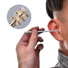Carica l&#39;immagine nel visualizzatore di Gallery, Set di strumenti per la pulizia del cerume in acciaio inossidabile - Ozerty
