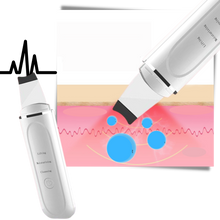 Carica l&#39;immagine nel visualizzatore di Gallery, Scrubber ultrasonico per la pulizia profonda del viso - Ozerty
