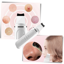 Carica l&#39;immagine nel visualizzatore di Gallery, Scrubber ultrasonico per la pulizia profonda del viso
