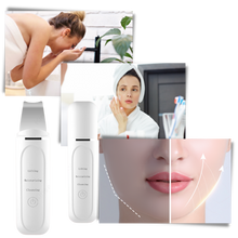 Carica l&#39;immagine nel visualizzatore di Gallery, Scrubber ultrasonico per la pulizia profonda del viso - Ozerty
