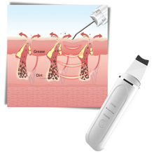 Carica l&#39;immagine nel visualizzatore di Gallery, Scrubber ultrasonico per la pulizia profonda del viso - Ozerty
