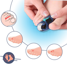 Carica l&#39;immagine nel visualizzatore di Gallery, Raddrizzatore per dita dei piedi regolabile e discreto - Ozerty
