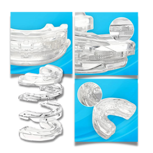 Carica l&#39;immagine nel visualizzatore di Gallery, Dispositivo antirussamento avanzato - Ozerty
