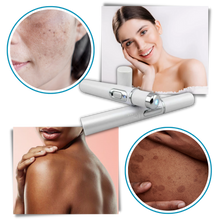 Carica l&#39;immagine nel visualizzatore di Gallery, Penna laser blu per la rimozione delle macchie scure - Ozerty
