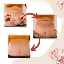 Carica l&#39;immagine nel visualizzatore di Gallery, Massaggiatore per cellulite a vibrazione ad alta frequenza - Ozerty
