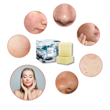 Carica l&#39;immagine nel visualizzatore di Gallery, Sapone antiacne naturale al sale marino - Ozerty
