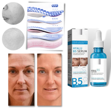 Carica l&#39;immagine nel visualizzatore di Gallery, Siero ringiovanente all&#39;acido ialuronico Hyalu B5 - Ozerty

