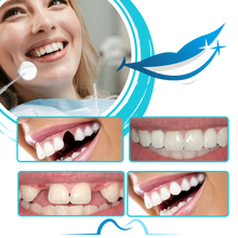 Carica l&#39;immagine nel visualizzatore di Gallery, Kit per la Modellazione di Denti Finti Riutilizzabile - Ozerty
