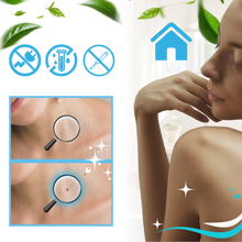 Carica l&#39;immagine nel visualizzatore di Gallery, Tecnica di legatura per la rimozione - Ozerty
