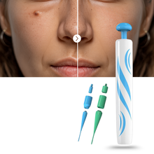 Carica l&#39;immagine nel visualizzatore di Gallery, Tecnica di legatura per la rimozione - Ozerty
