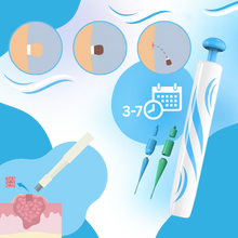 Carica l&#39;immagine nel visualizzatore di Gallery, Tecnica di legatura per la rimozione - Ozerty
