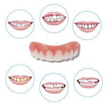 Carica l&#39;immagine nel visualizzatore di Gallery, Faccette dentali a scatto - Ozerty
