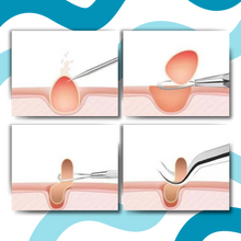 Carica l&#39;immagine nel visualizzatore di Gallery, Pinzette a punta ultra precise - Ozerty
